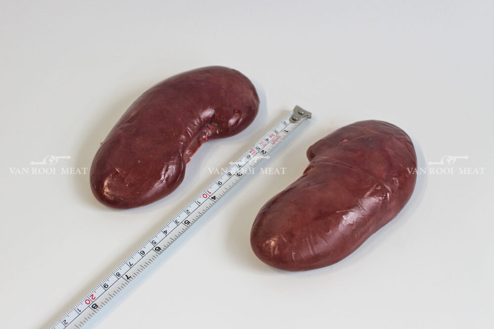 Kidney-3