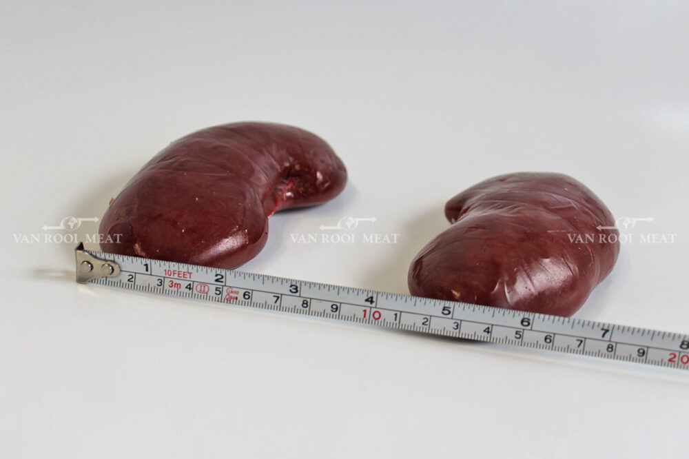 Kidney-4